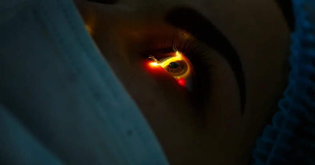 YAG Laser Capsulotomy