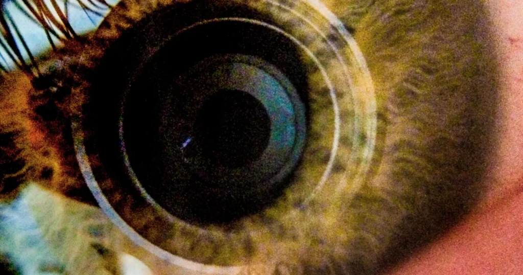 Oculoplastic & Reconstructive Surgery