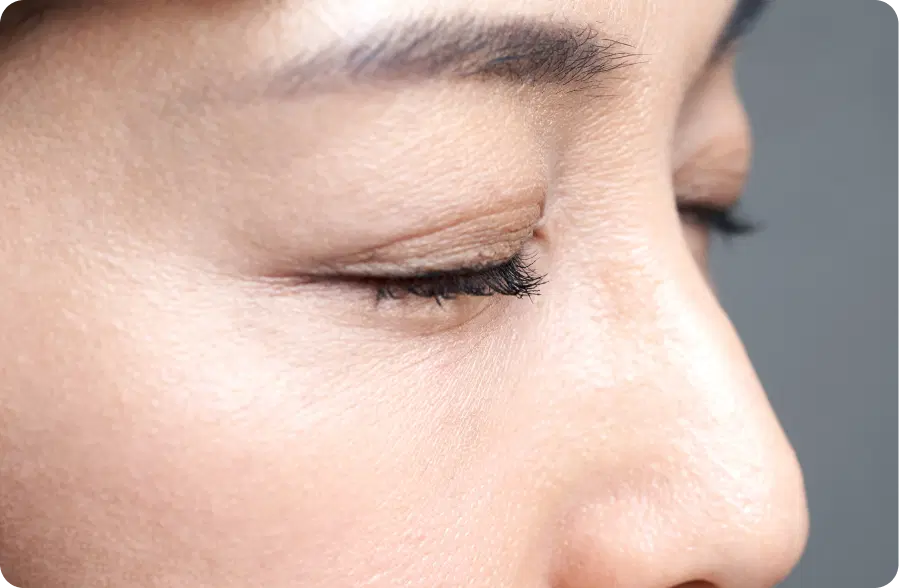 Keratoconus Treatment